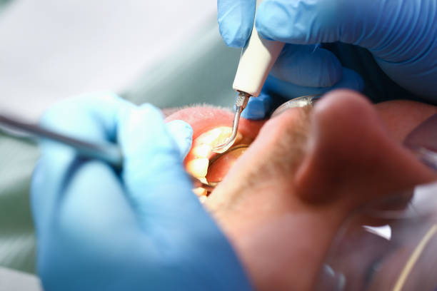 Best Holiday Emergency Dentist in Edna, TX