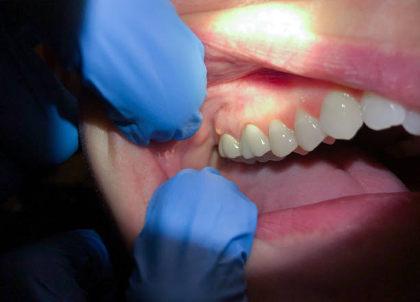 Best Emergency Dental Extractions in Edna, TX