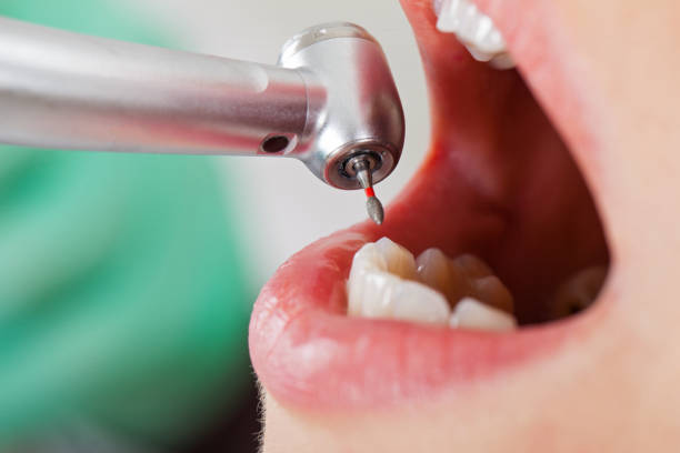 Best Emergency Root Canal Treatment in Edna, TX